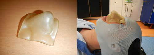 3D printing filter allows radiation therapy more effective